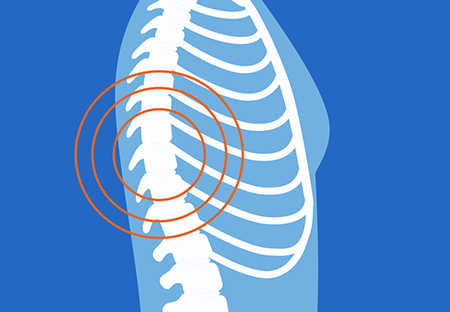 A graphical representation of skeleton with a curved spine